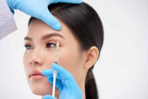 لیفت شقیقه با بوتاکس