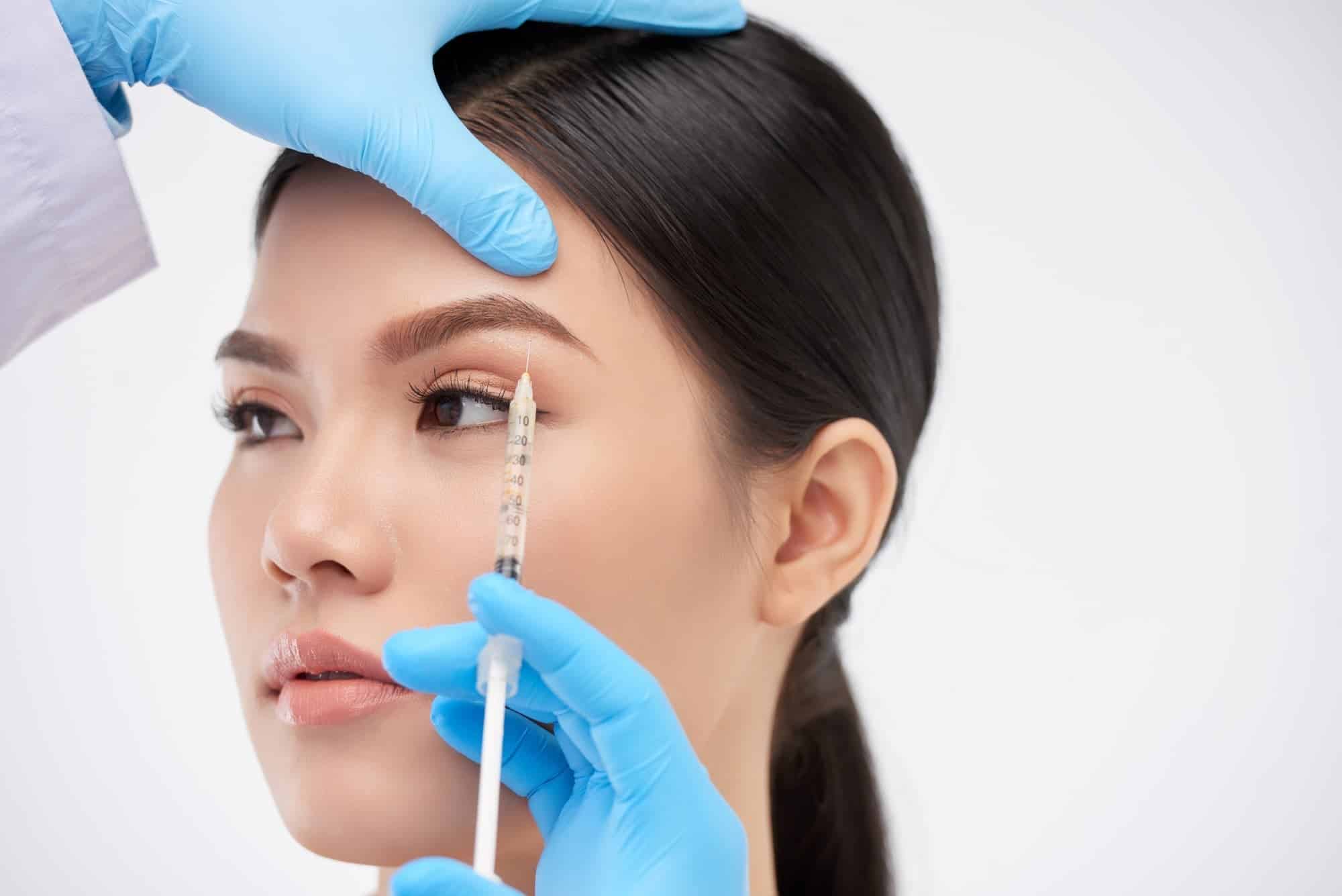 لیفت شقیقه با بوتاکس