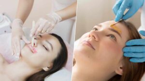مقایسه الکترولیز با وکس (شمعگذاری)