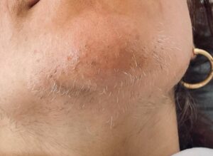 نتیجه الکترولیز
