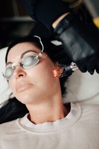 ترمیم پوست بعد از لیزر co2