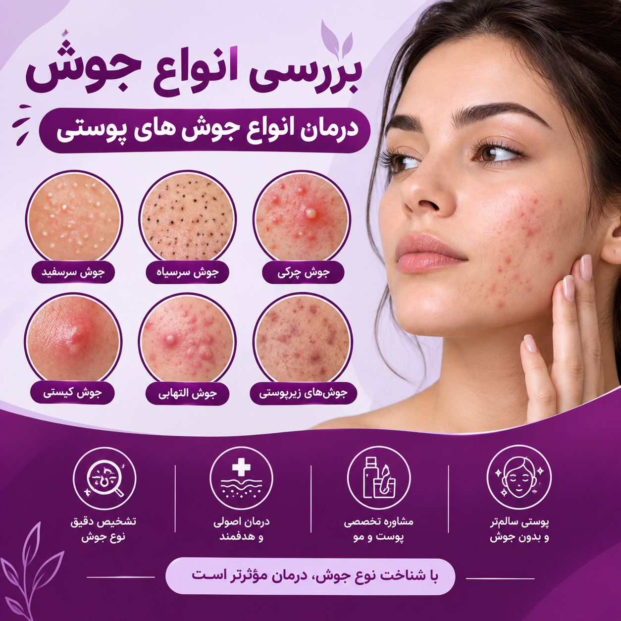 بررسی انواع جوش