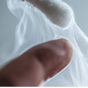 برداشتن زگیل تناسلی در کرج