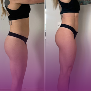 قیمت فیلر باسن در کرج