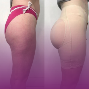 قیمت ژل باسن در کرج