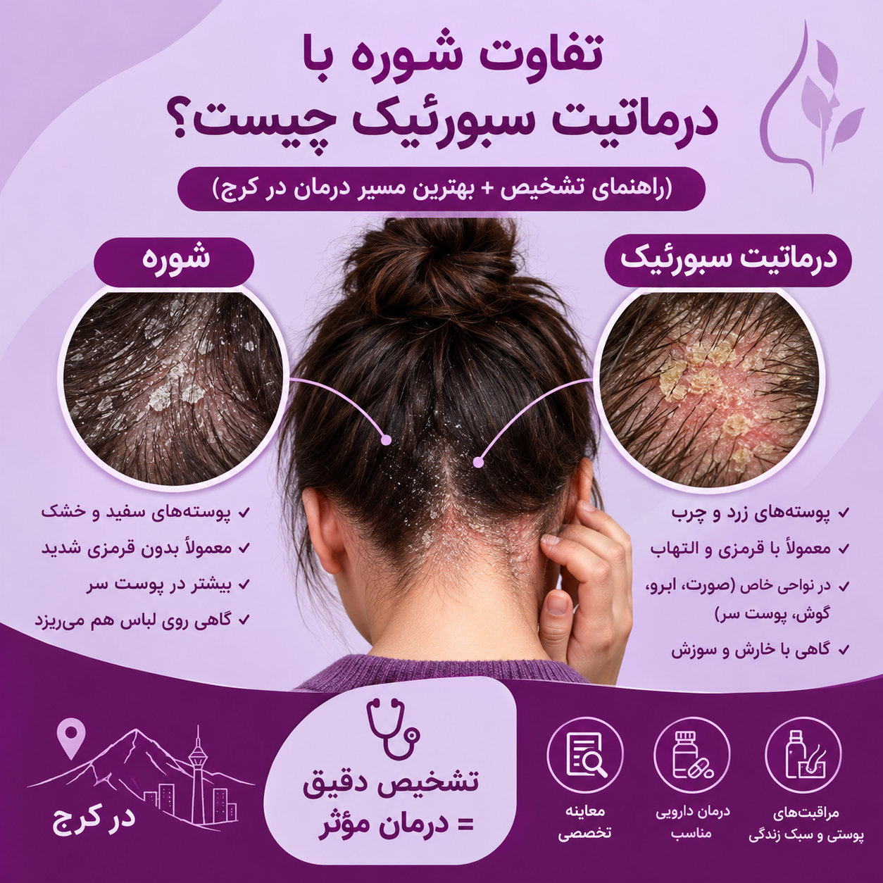 تفاوت شوره با درماتیت سبورئیک