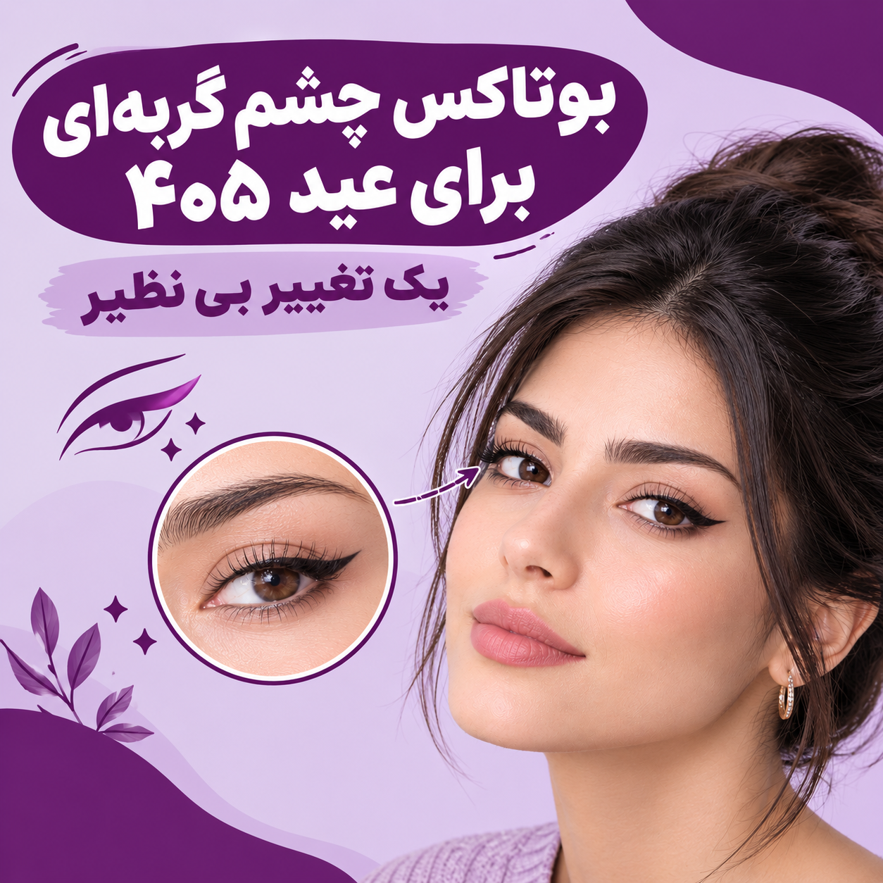 بوتاکس چشم گربه ای برای عید 405