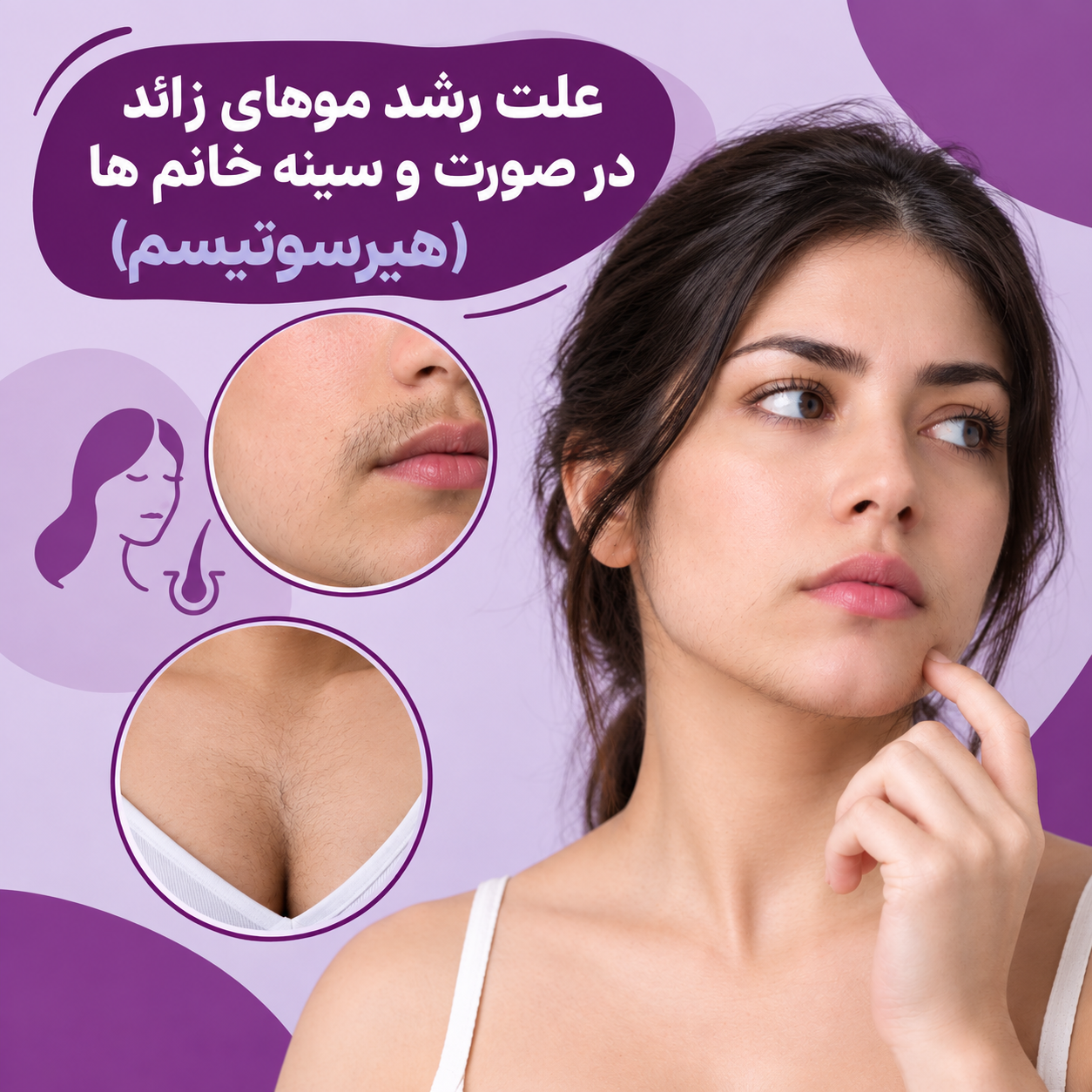 موهای زائد در صورت