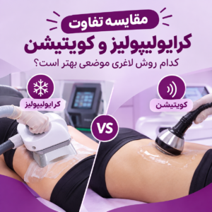 تفاوت کرایولیپولیز و کویتیشن