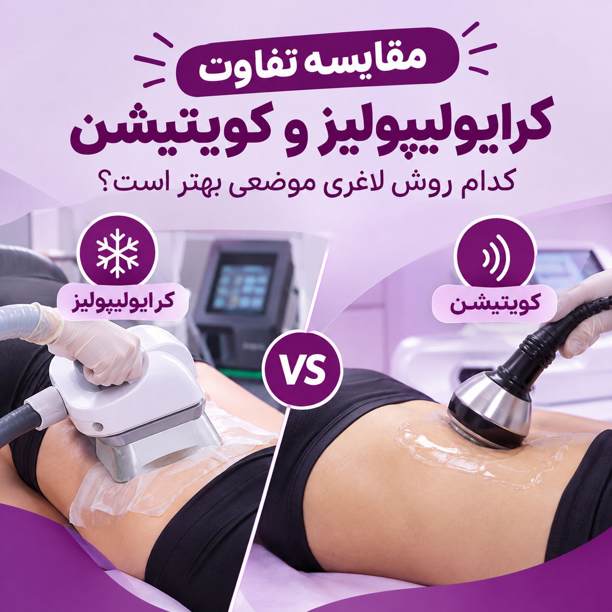 تفاوت کرایولیپولیز و کویتیشن
