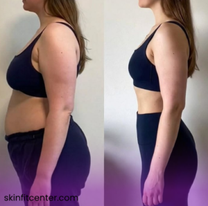 دستگاه لاغری برای کاهش چربی موضعی شکم