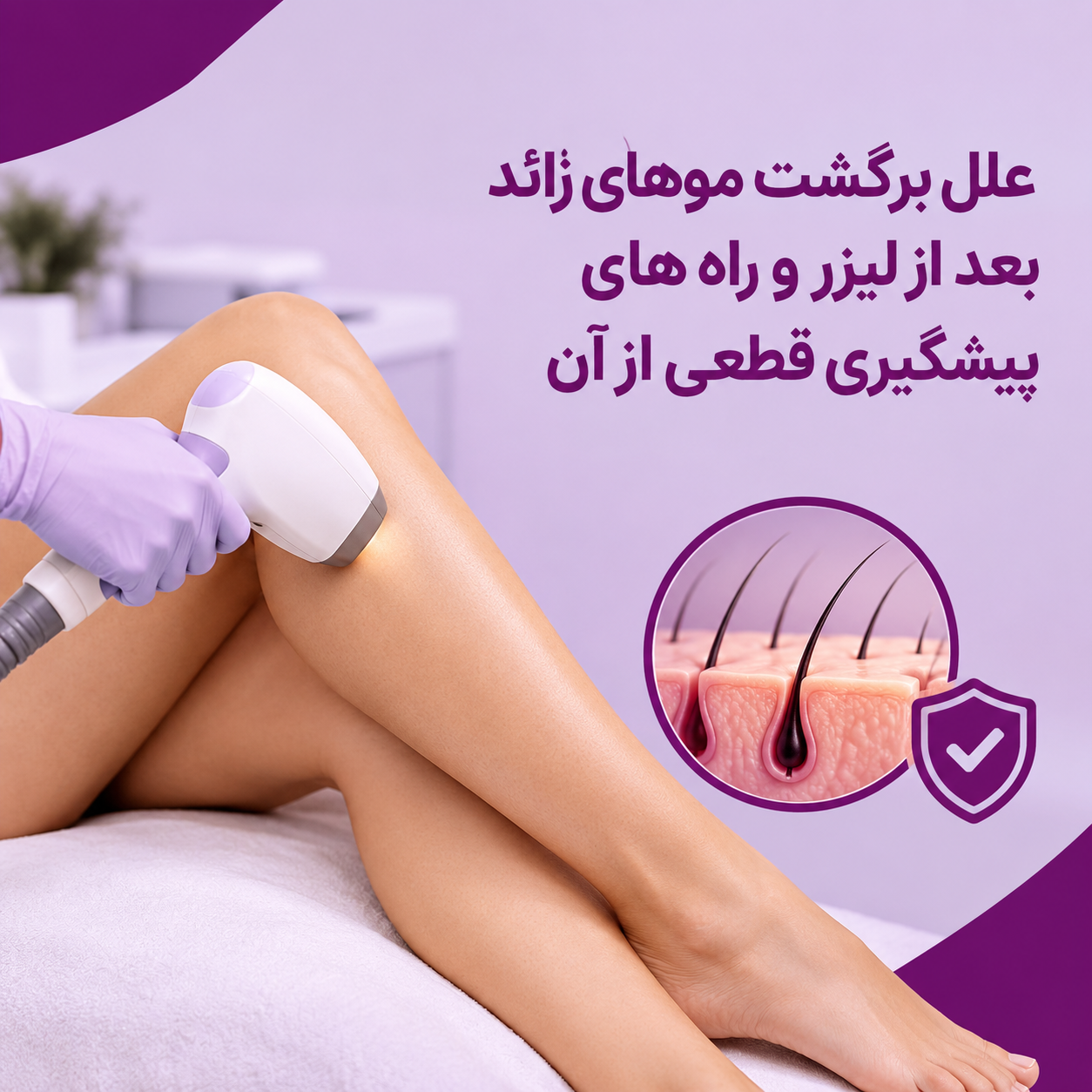 علل برگشت موهای زائد